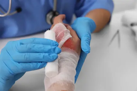burn injury
